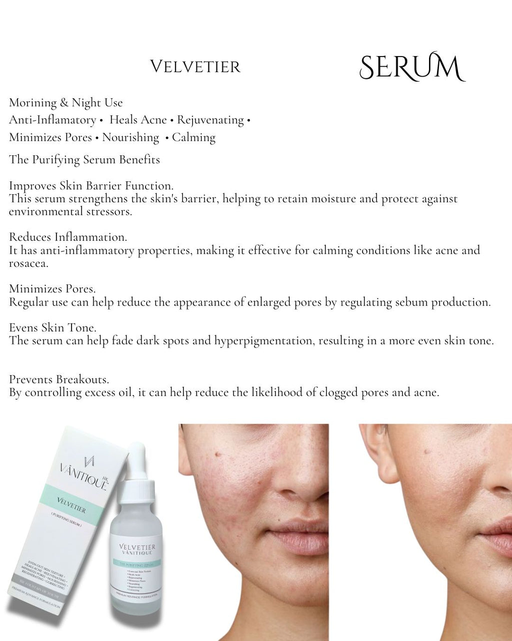 Velvitier Serum (Pimple Prone Serum)